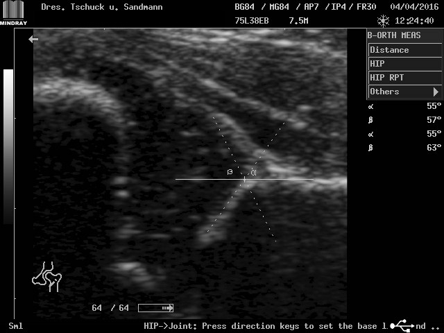 Ultraschall Orthopäde Moers